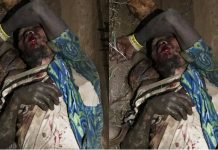W/R: Thief sustains life threatening burns after getting electrocuted by ECG cables
