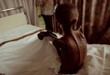 HIV infections on the rise among youth in Bolgatanga – Health Directorate warns