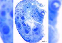 How scientists counted all 10,000 nerve fibres in the human clitoris