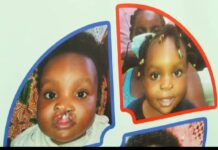 Level stigmatization against children with cleft lip reduces – Experts
