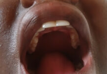 Unregistered oral health professionals are being used to render services – OHPAG President