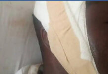 Senya Bereku – C/R: Man beaten over missing genitals