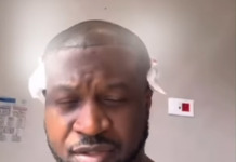 Peter Okoye of P-Square fame gets a hair implant in Turkey