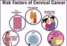 Urgent call for action as Ghana faces critical cervical cancer crisis