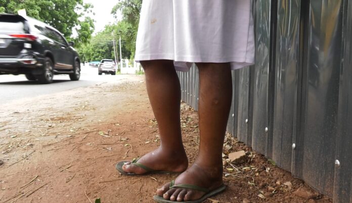 Kidney disease patient