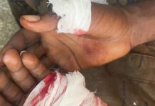 Kasoa: Five injured as traders, task force clash over market decongestion