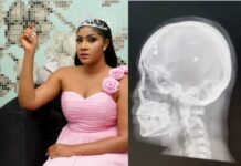 Angela Okorie reveals bullet fragments still in her head after 2019 assassination attempt