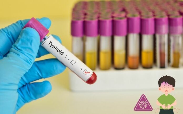 typhoid