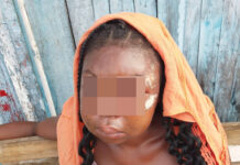 Sekondi: Commercial sex worker beaten by client for allegedly not satisfying him