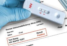 FDA issues public health alert over fake HIV test kits on Ghanaian market