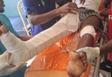 WNR: 37-year-old teacher in critical condition after being hit by speeding Sprinter bus at Anhwiaso