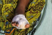 Mother who allegedly cut daughter’s toe to appear in court today