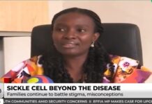 2 in every 100 babies born in Ghana have sickle cell disease – Health expert