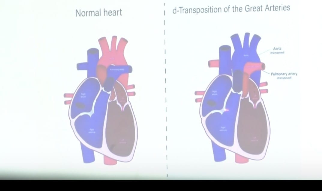 The human heart