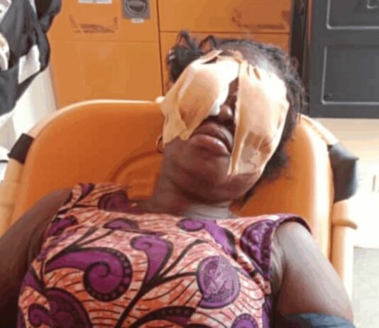 WNR: 55-year-old man jailed 5 years for stabbing sister in the eyes at Sefwi Abrokofe
