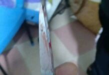 Tragedy in Aboso Achiase: 24-year-old man kills neighbour with scissors during dispute over route used by a tricycle Scissors