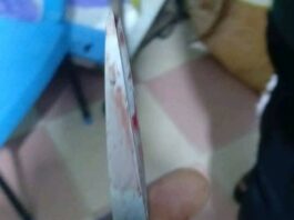 Tragedy in Aboso Achiase: 24-year-old man kills neighbour with scissors during dispute over route used by a tricycle Scissors