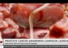 Prostate Cancer: The earlier you know, the more options you have – Health expert Prostate Cancer
