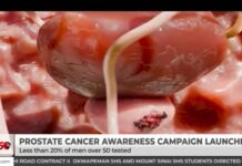 Prostate Cancer: The earlier you know, the more options you have – Health expert Prostate Cancer