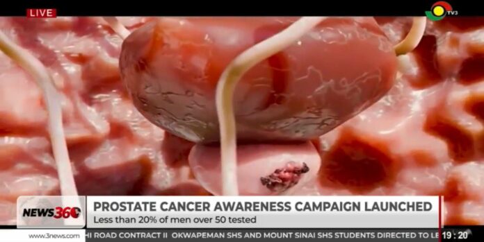 WhatsApp Image 2026-09-03 at 13.49.35 (1) Prostate Cancer