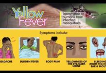 Upper West intensifies yellow fever vaccination as outbreak affects seven districts